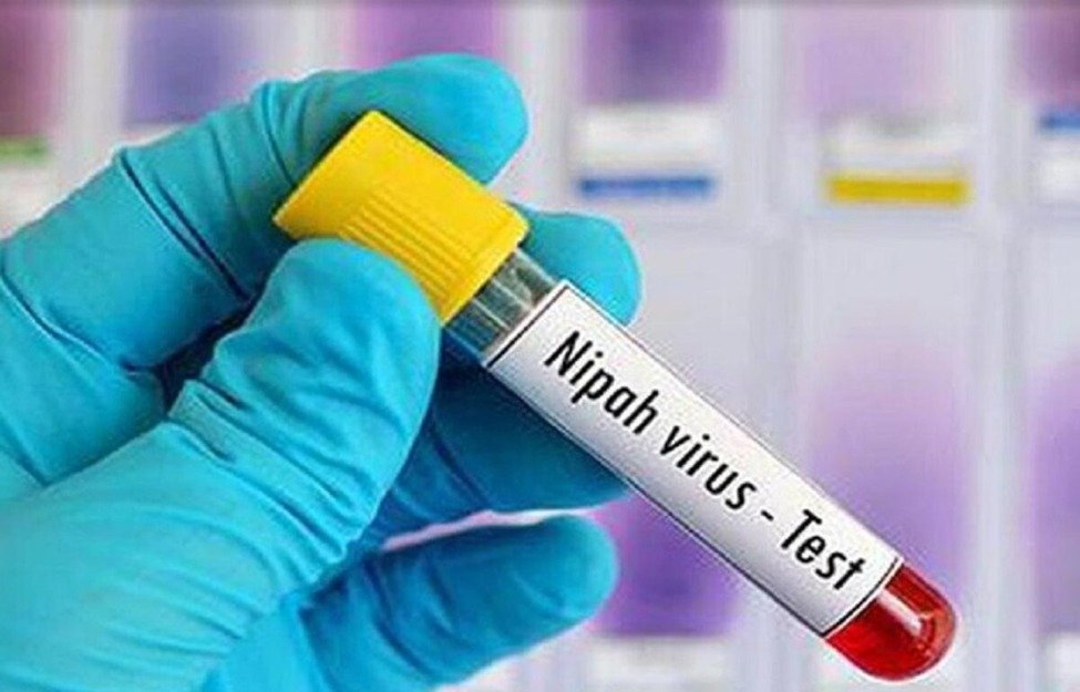 nipah virus
